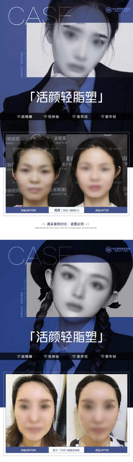 医美脸部填充案例海报-采灵感-https://www.cailinggan.com/