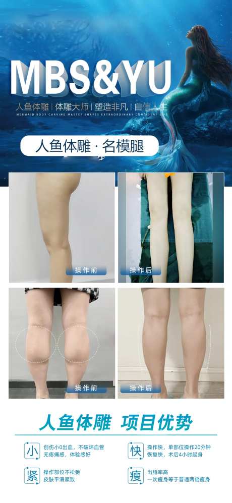 人鱼体雕吸脂医美腿对比图-采灵感-https://www.cailinggan.com/