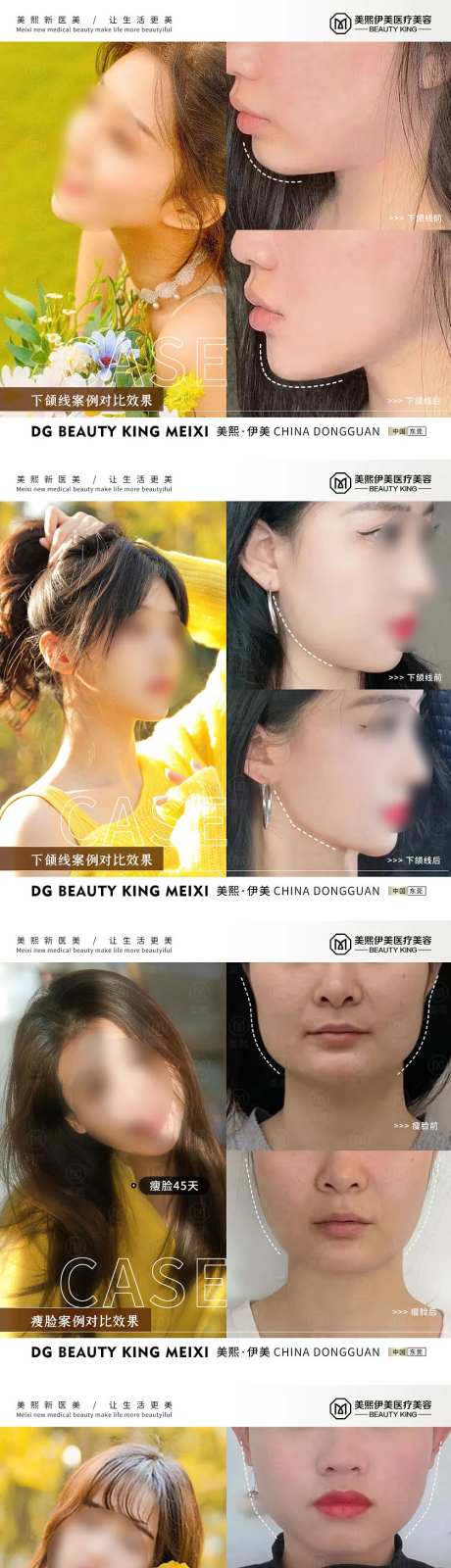 瘦脸案例系列海报-采灵感-https://www.cailinggan.com/