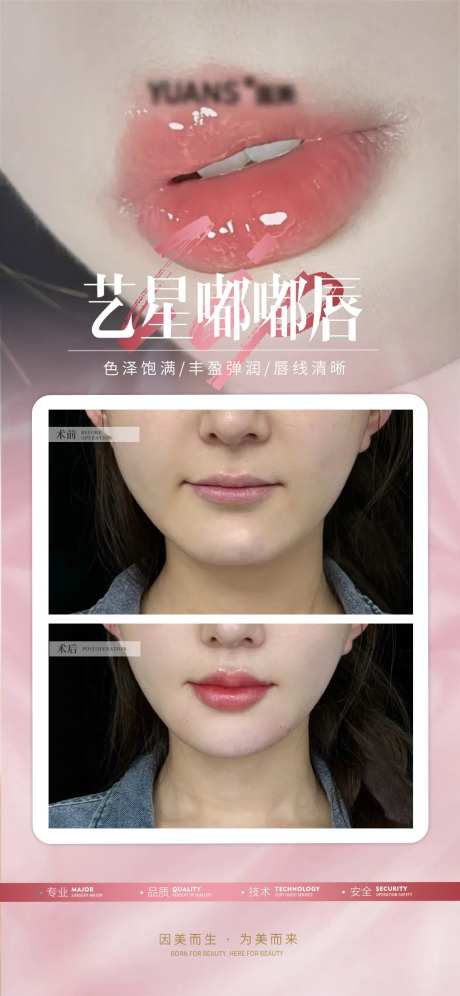 医美嘟嘟唇案例海报-采灵感-https://www.cailinggan.com/