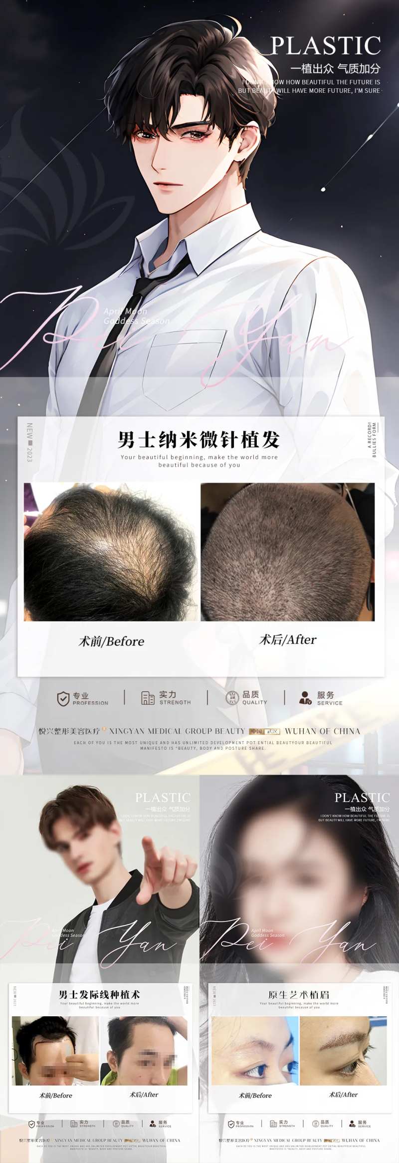 植发案例合集-采灵感-cailinggan.com