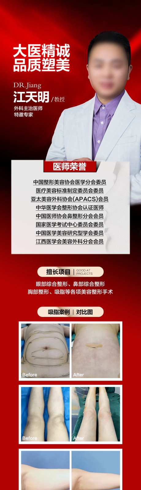 医美专家介绍吸脂丰胸案例对比-采灵感-https://www.cailinggan.com/