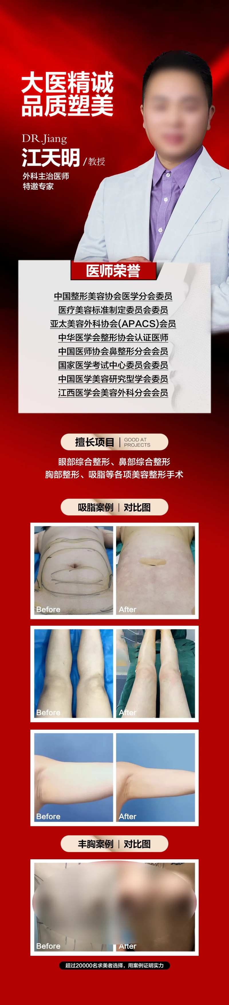 医美专家介绍吸脂丰胸案例对比-采灵感-cailinggan.com