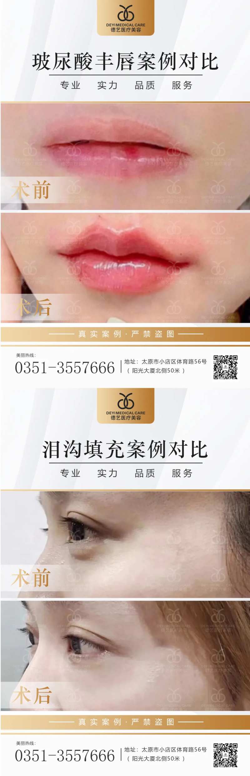 医美案例对比图-采灵感-cailinggan.com
