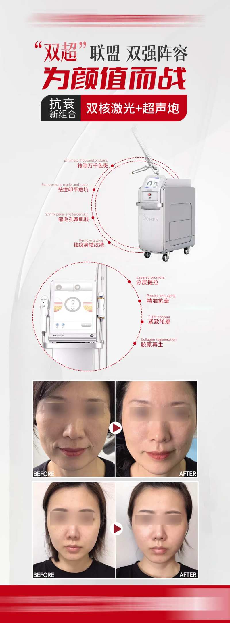 双核激光超声炮抗衰海报-采灵感-cailinggan.com