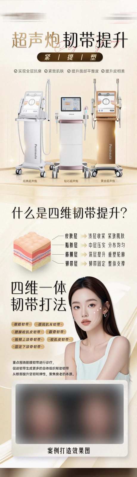 超声炮韧带提升-采灵感-https://www.cailinggan.com/