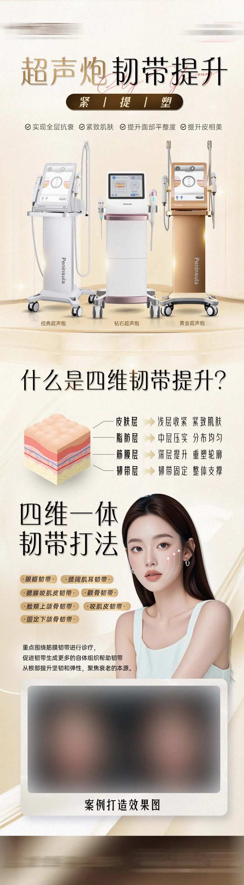 超声炮韧带提升-采灵感-cailinggan.com