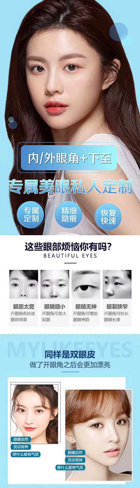 医美整形内外眼角双眼皮详情页-采灵感-https://www.cailinggan.com/