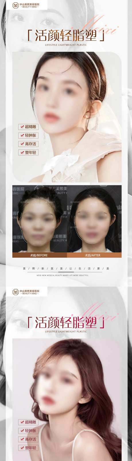 医美脸部填充案例海报-采灵感-https://www.cailinggan.com/