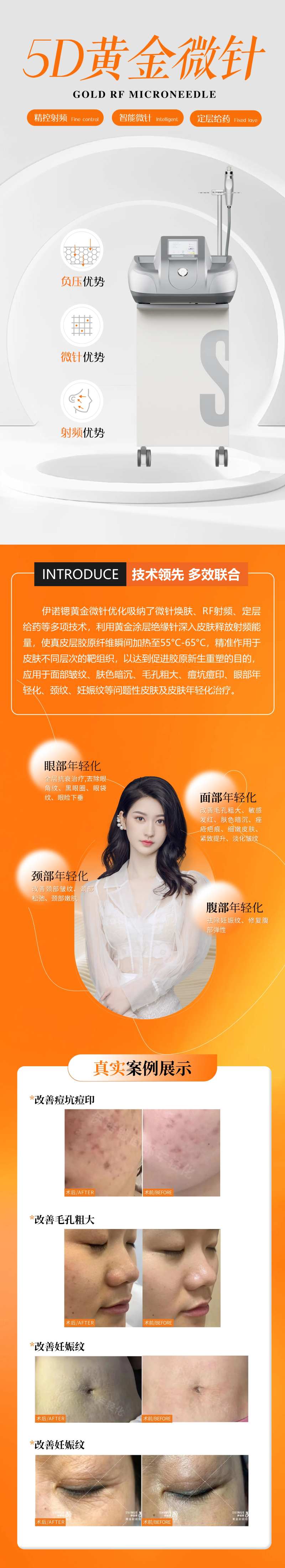 伊诺思黄金微针  -采灵感-cailinggan.com