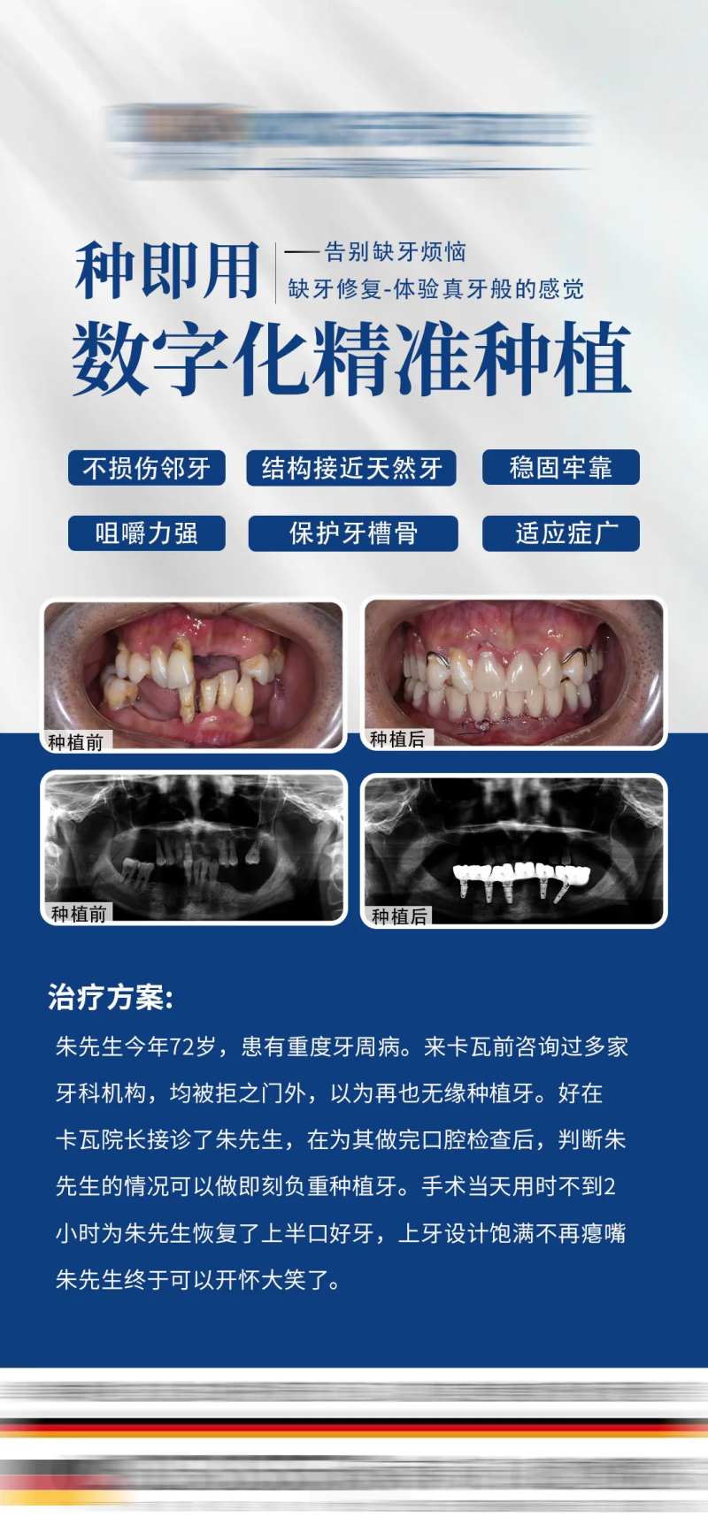 牙齿种植案例海报-采灵感-cailinggan.com