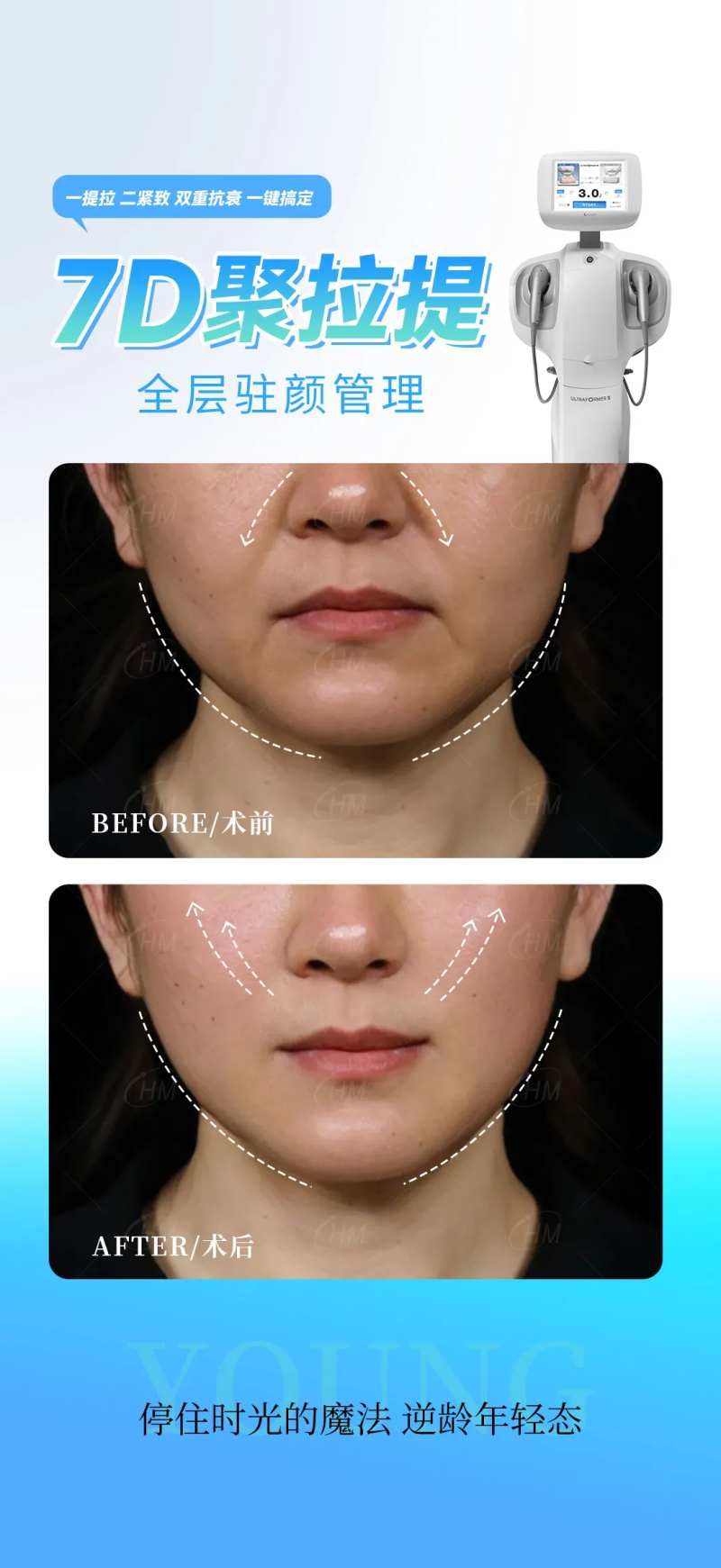 7D聚拉提案例海报-采灵感-cailinggan.com