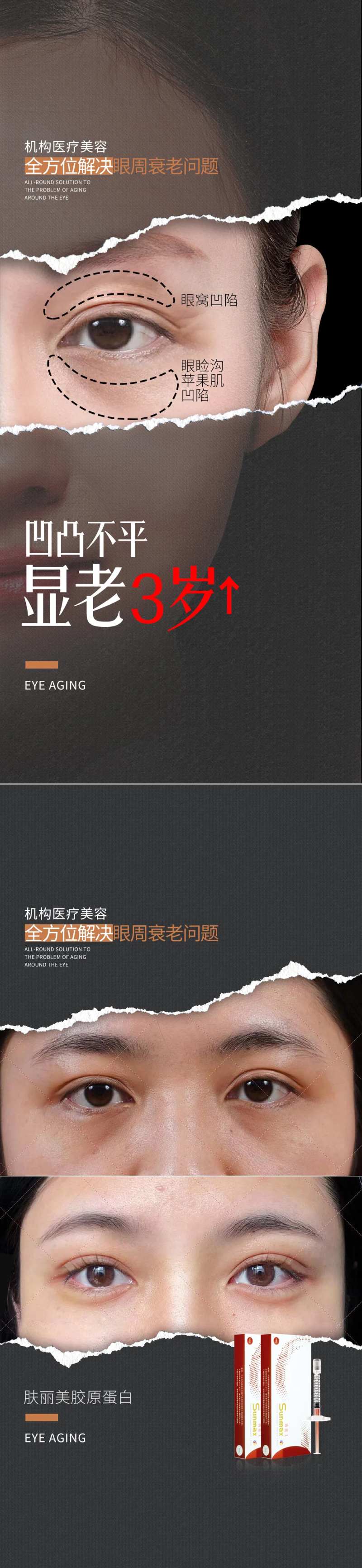 医美眼部年轻化海报-采灵感-cailinggan.com