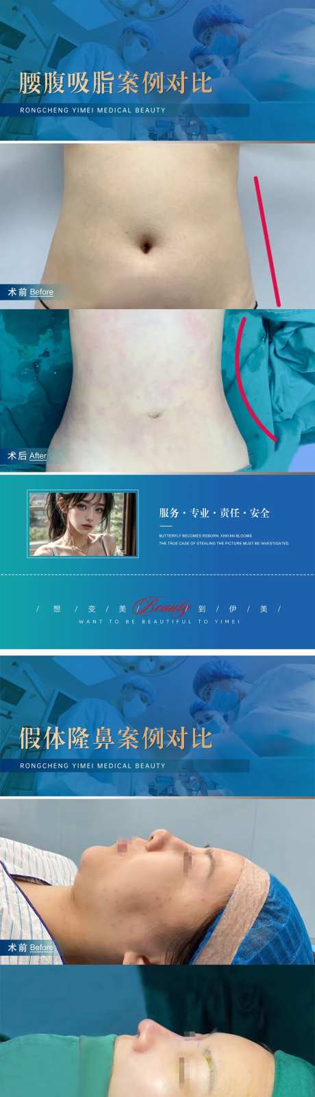 医美整形案例对比模版-采灵感-https://www.cailinggan.com/