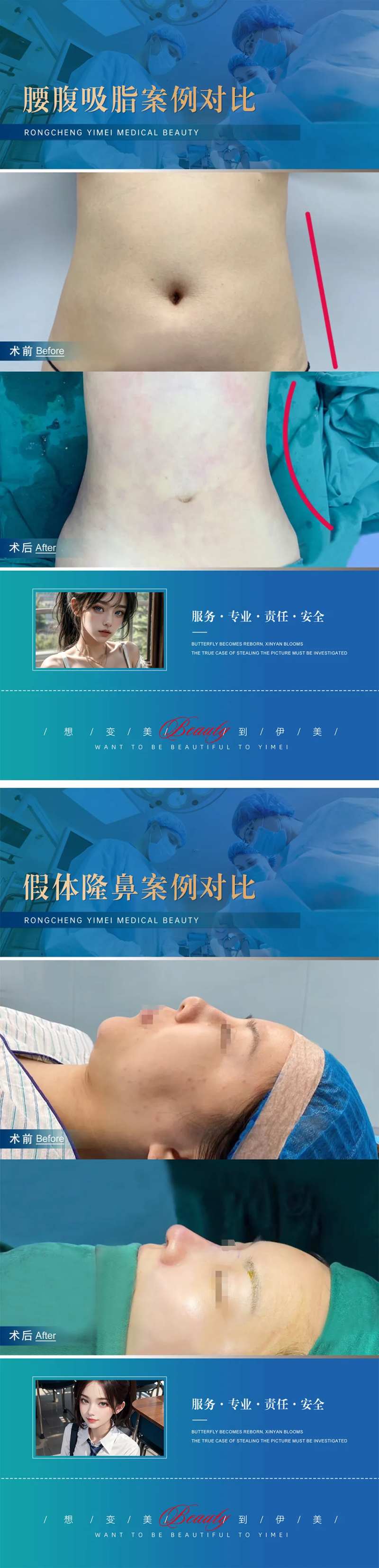 医美整形案例对比模版-采灵感-cailinggan.com
