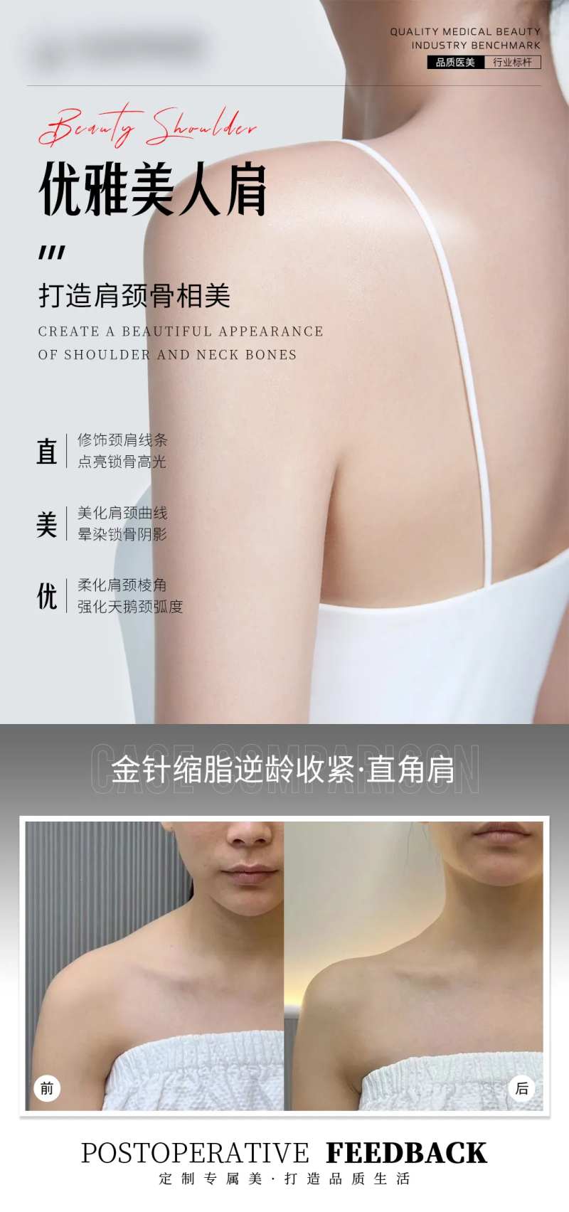 医美案例美人肩海报-采灵感-cailinggan.com