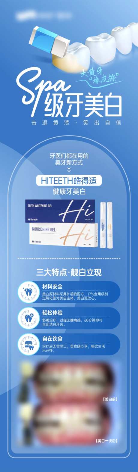 美白牙齿 -采灵感-https://www.cailinggan.com/