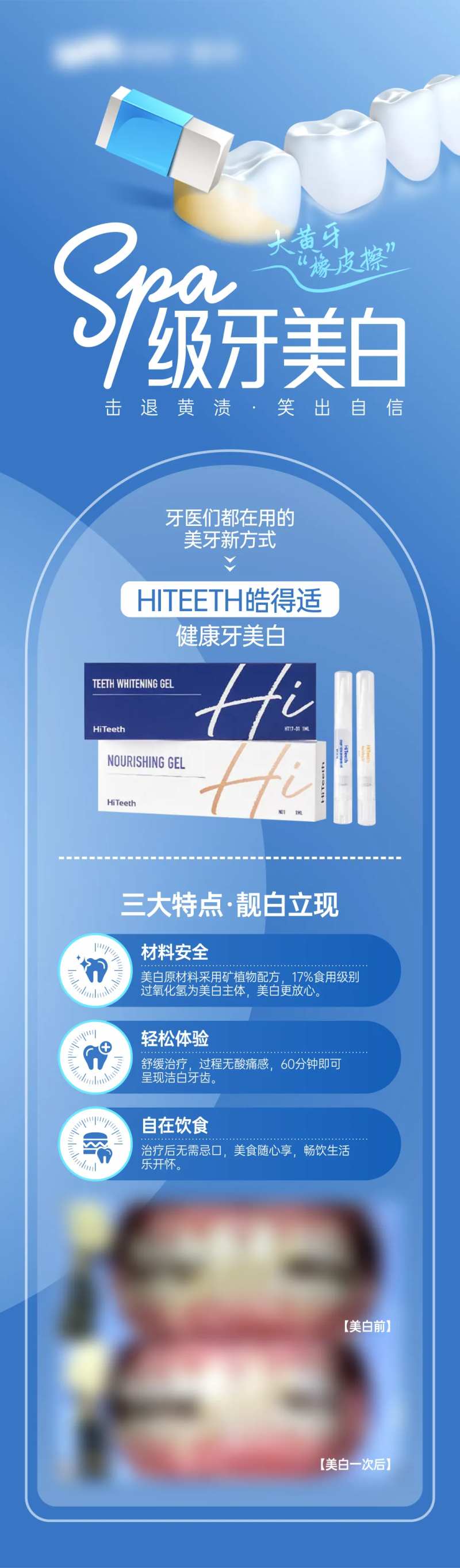 美白牙齿 -采灵感-cailinggan.com