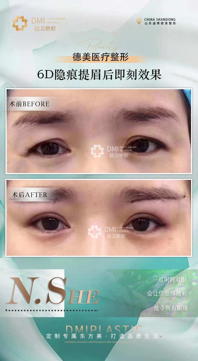 医美整形对比图-采灵感-cailinggan.com