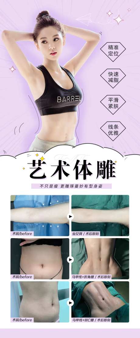 艺术体雕吸脂塑形整形案例-采灵感-https://www.cailinggan.com/