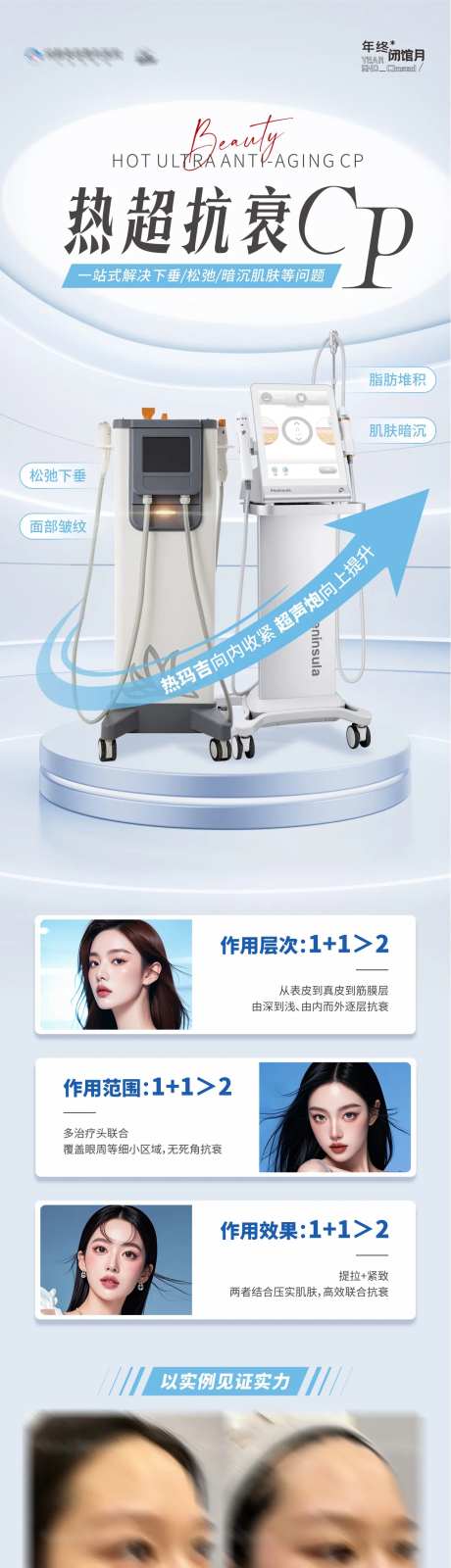 医美热玛吉超声炮仪器抗衰案例长图-采灵感-https://www.cailinggan.com/