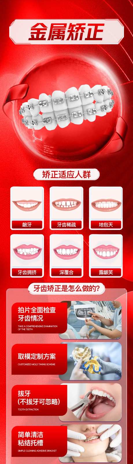 牙齿金属矫正活动长图-采灵感-https://www.cailinggan.com/