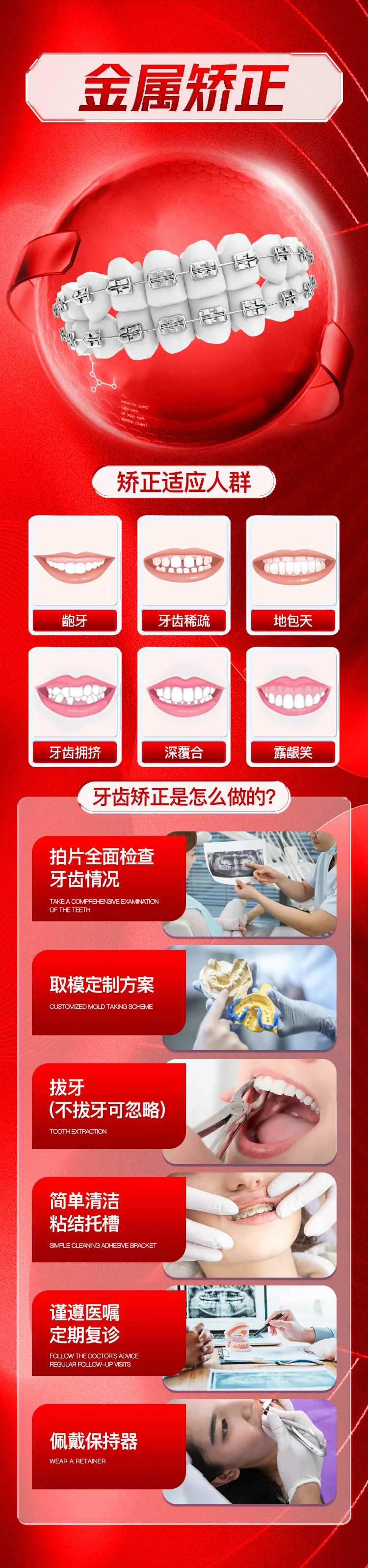 牙齿金属矫正活动长图-采灵感-cailinggan.com
