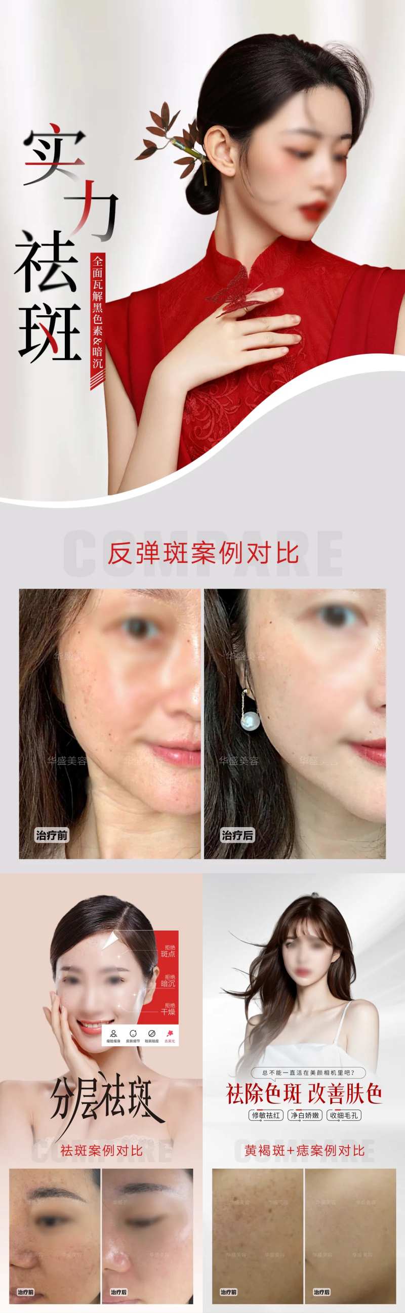 美业祛斑祛痣案例海报-采灵感-cailinggan.com