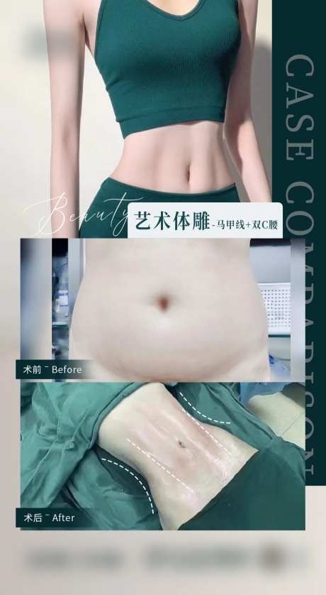 艺术体雕马甲线海报-采灵感-https://www.cailinggan.com/