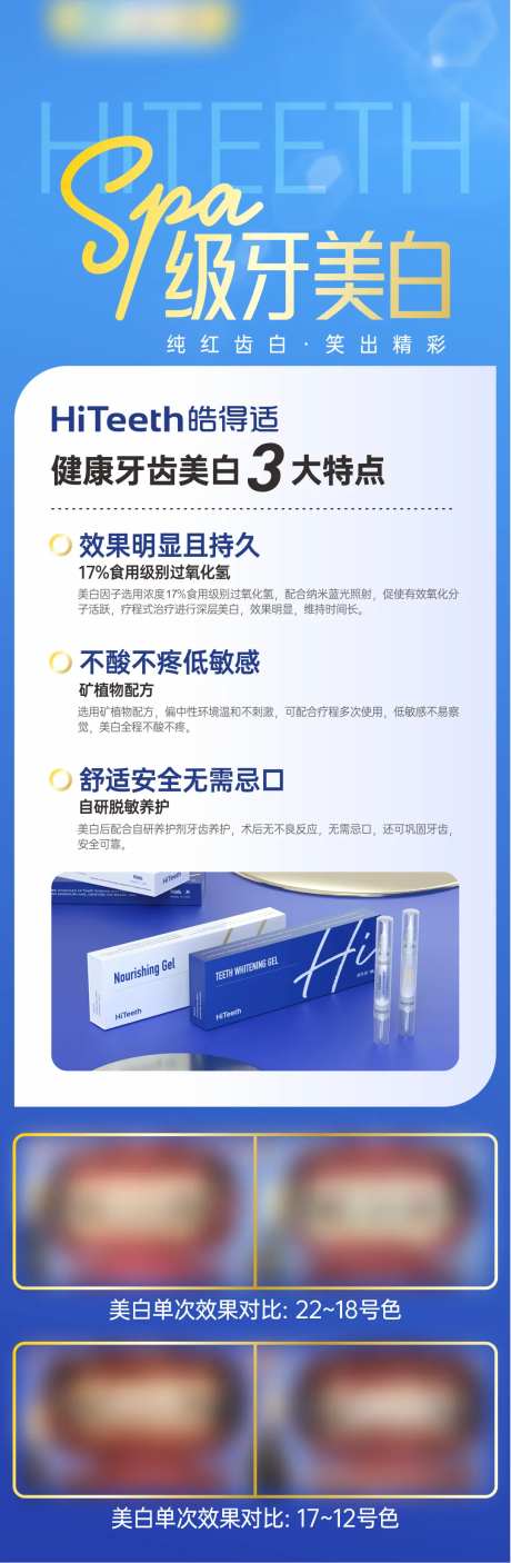 牙美白3大特点-采灵感-https://www.cailinggan.com/