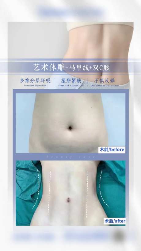 艺术体雕马甲线+双C腰案例-采灵感-https://www.cailinggan.com/