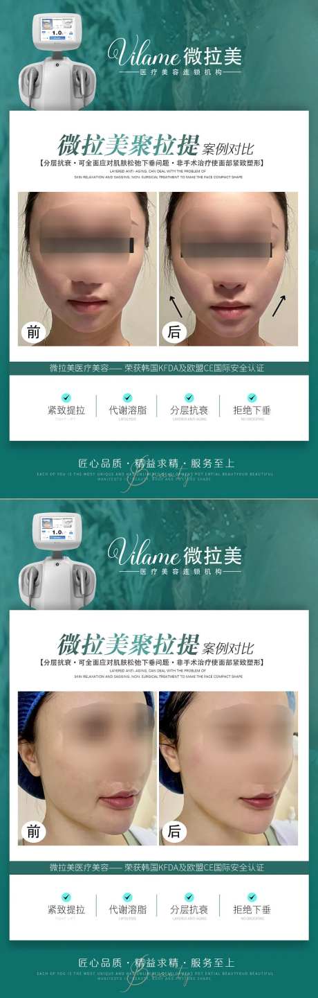 医美案例对比图海报 -采灵感-https://www.cailinggan.com/
