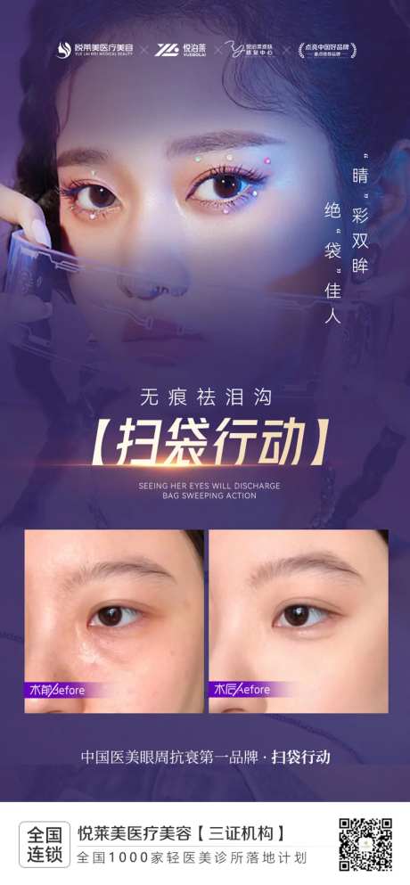祛眼袋案例-采灵感-https://www.cailinggan.com/