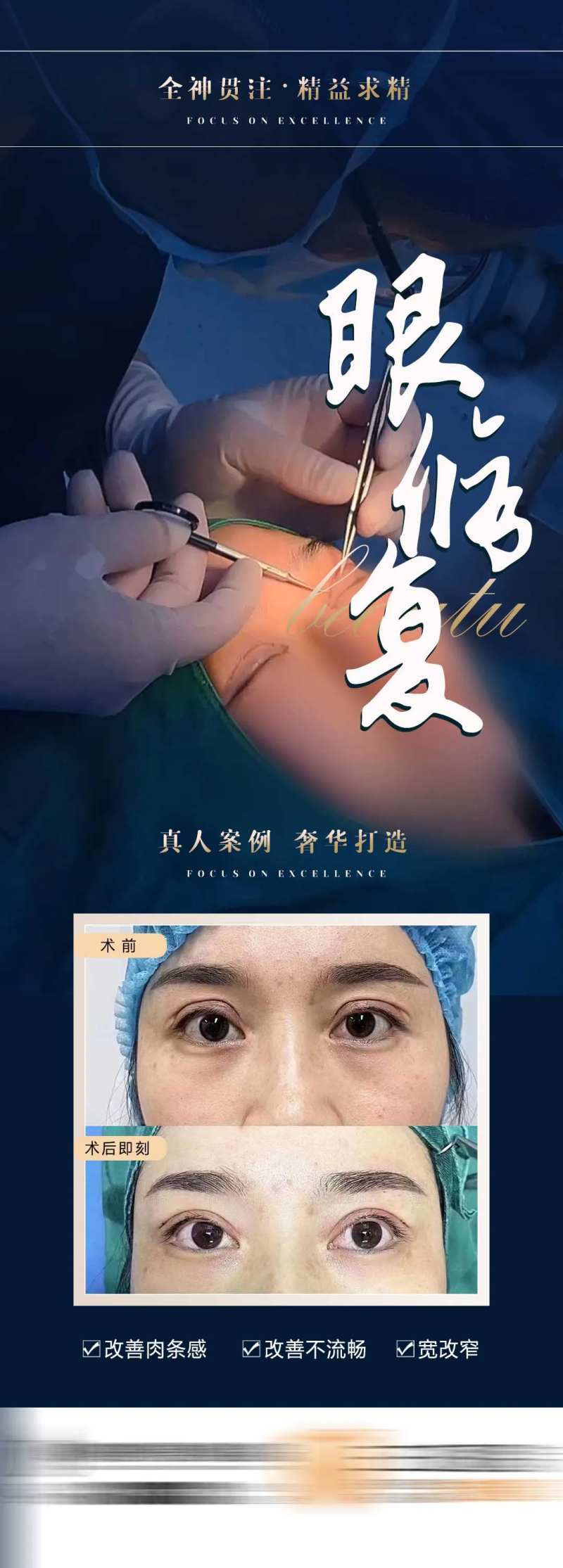 匠心医美整形双眼皮修复对比海报-采灵感-cailinggan.com