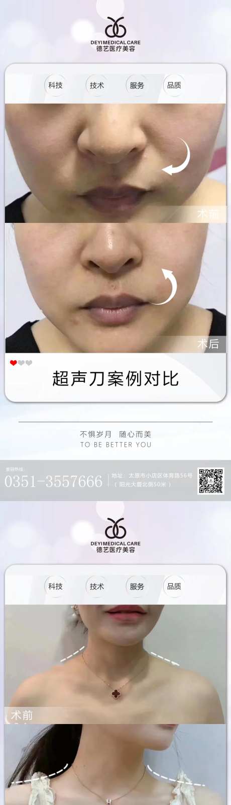 医美案例对比图-采灵感-https://www.cailinggan.com/