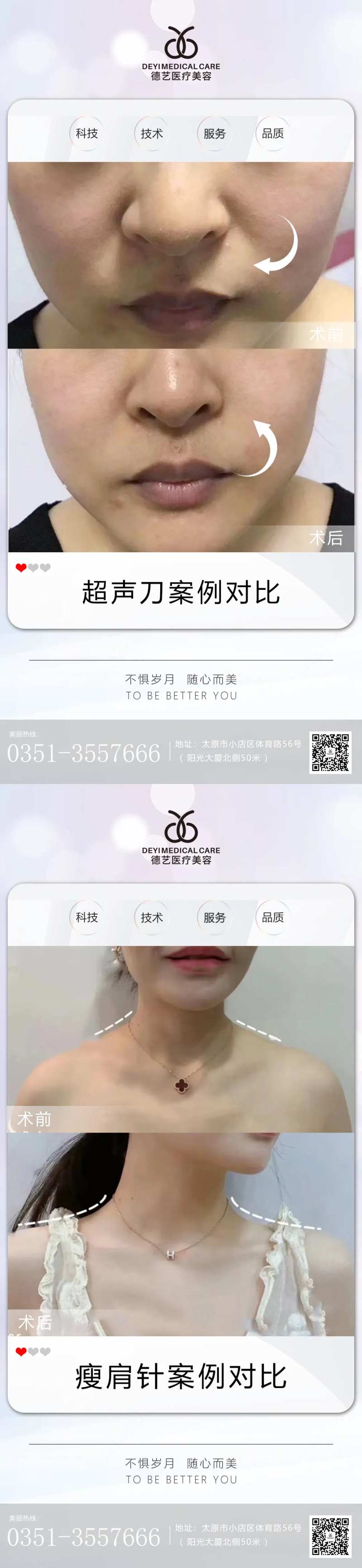 医美案例对比图-采灵感-cailinggan.com