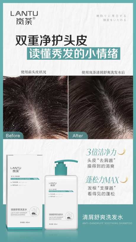 去屑洗发水头皮对比海报-采灵感-https://www.cailinggan.com/