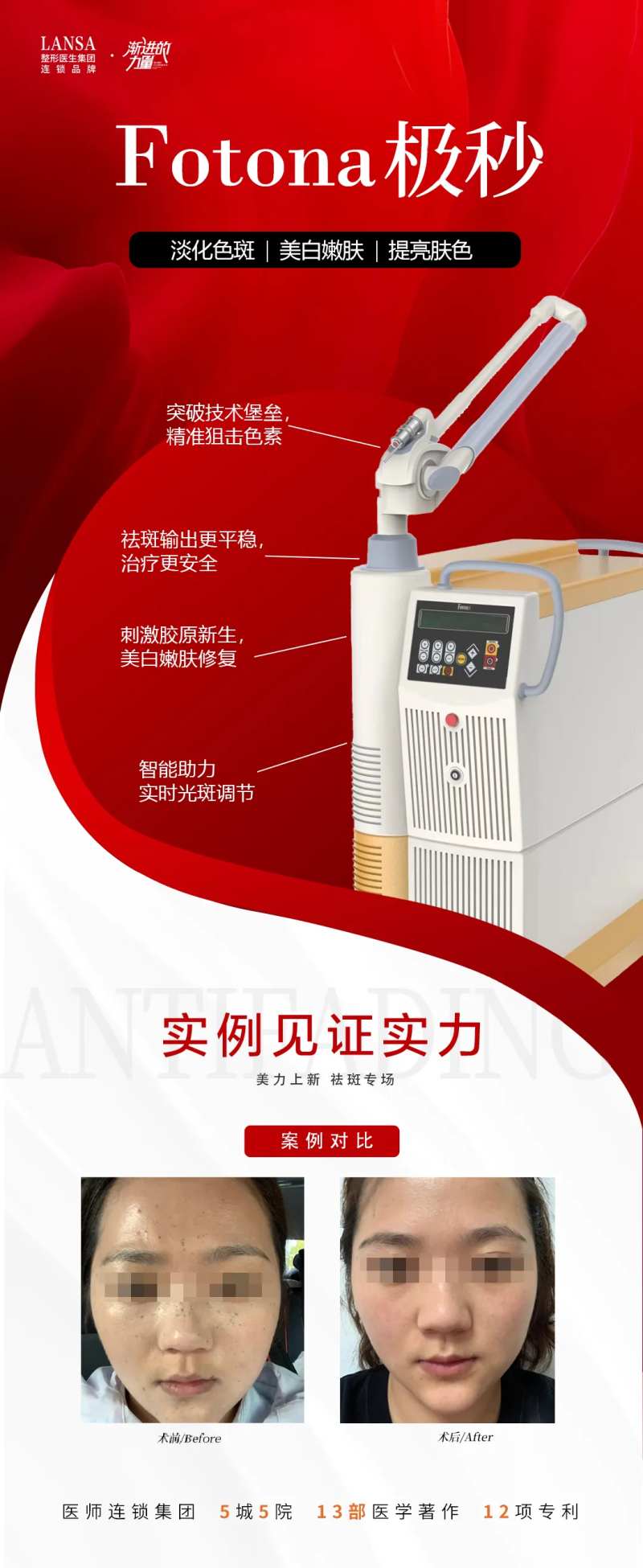 FOTONA极秒-采灵感-cailinggan.com