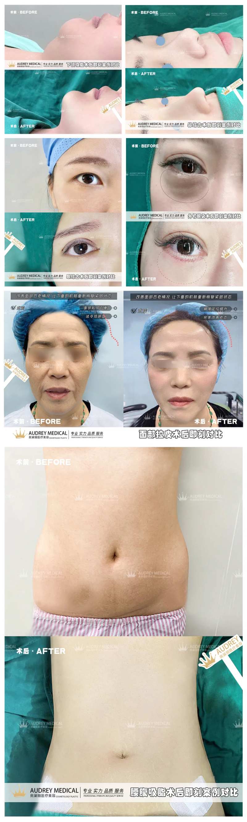 医美整形案例分享海报-采灵感-cailinggan.com