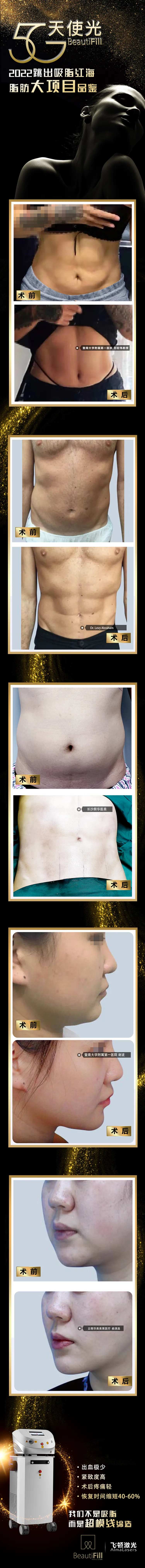 医美天使光对比案例长图-采灵感-cailinggan.com