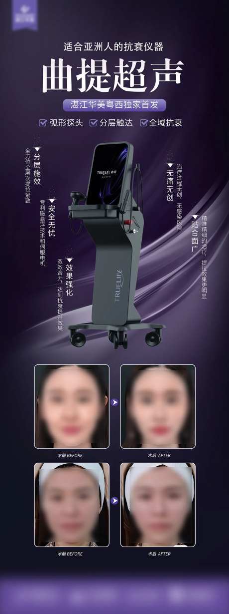 曲提超声案例对比海报-采灵感-https://www.cailinggan.com/