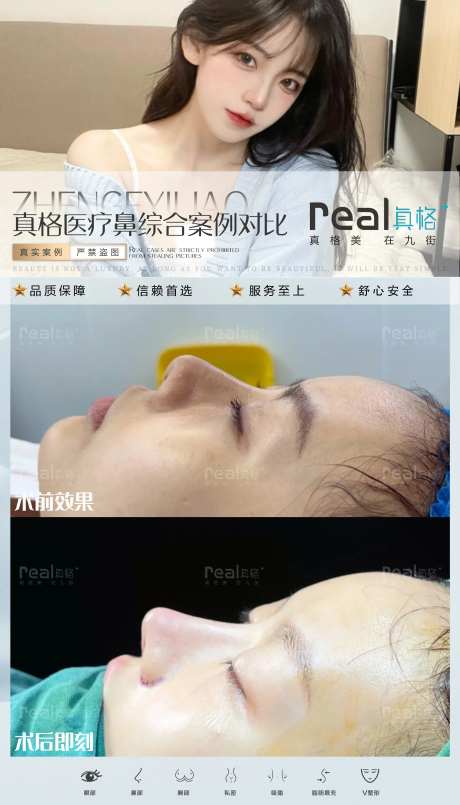 医美案例对比图-采灵感-https://www.cailinggan.com/