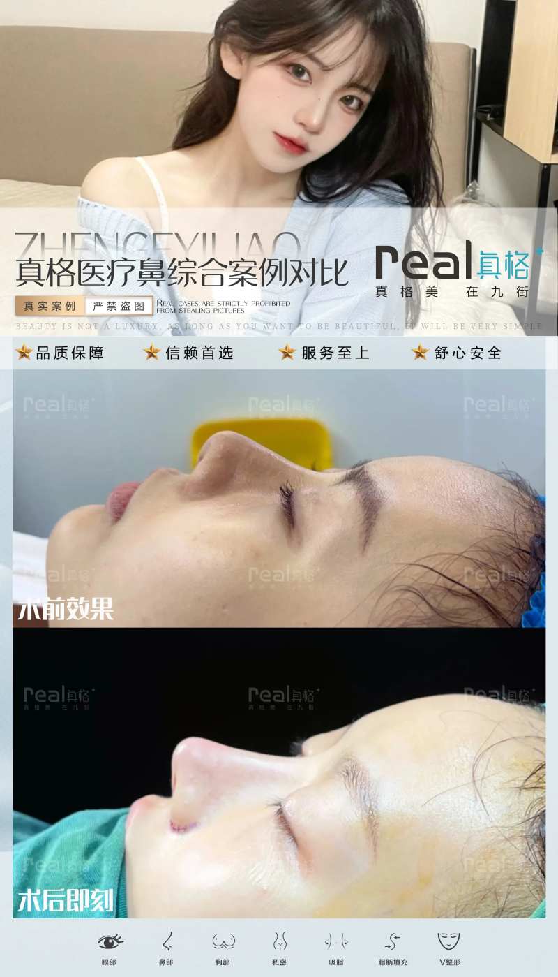 医美案例对比图-采灵感-cailinggan.com