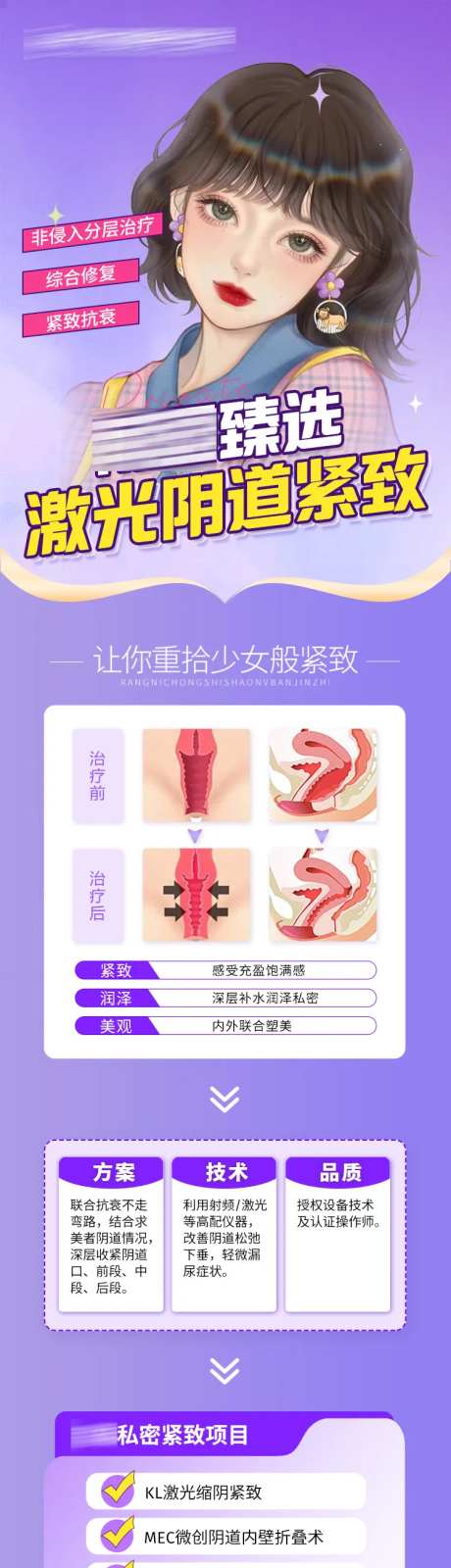 阴道紧缩术-采灵感-https://www.cailinggan.com/