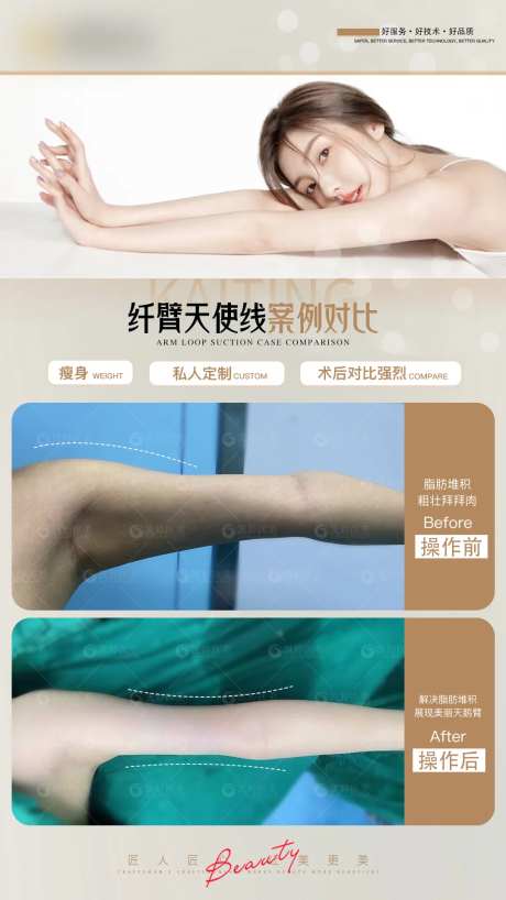 医美案例对比图纤臂臂-采灵感-https://www.cailinggan.com/