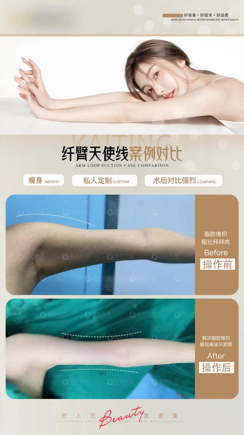 医美案例对比图纤臂臂-采灵感-cailinggan.com