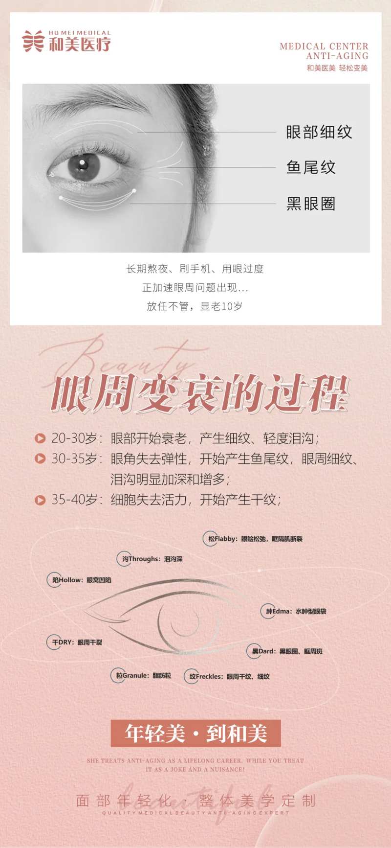 眼周衰老过程海报-采灵感-cailinggan.com