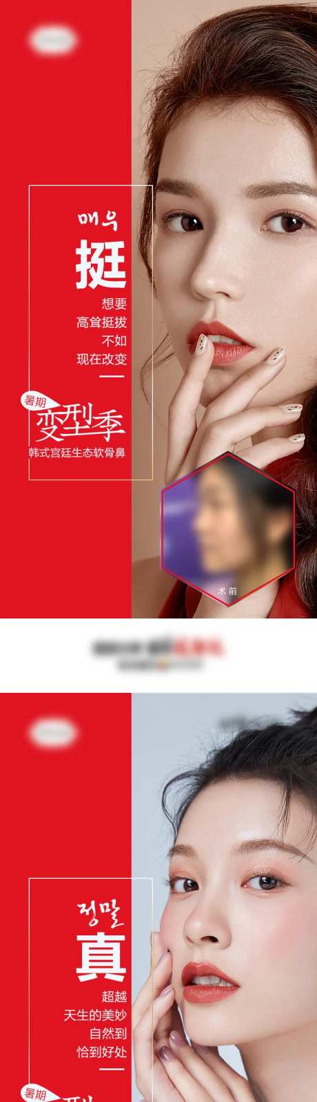 医美整形隆鼻暑期变型记前后对比案例海-采灵感-https://www.cailinggan.com/