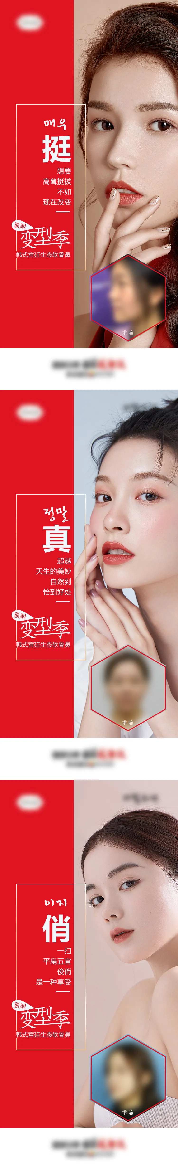 医美整形隆鼻暑期变型记前后对比案例海-采灵感-cailinggan.com