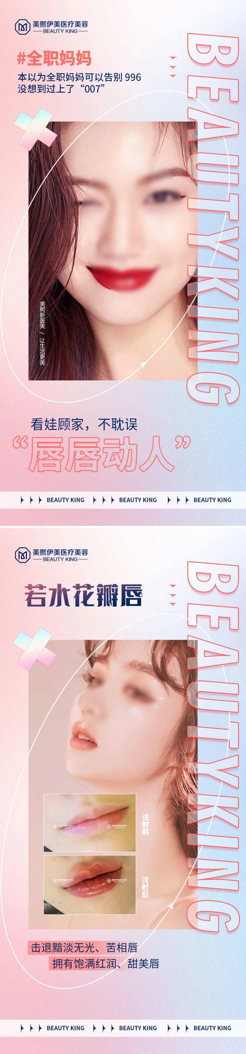 玻尿酸丰唇系列海报-采灵感-cailinggan.com